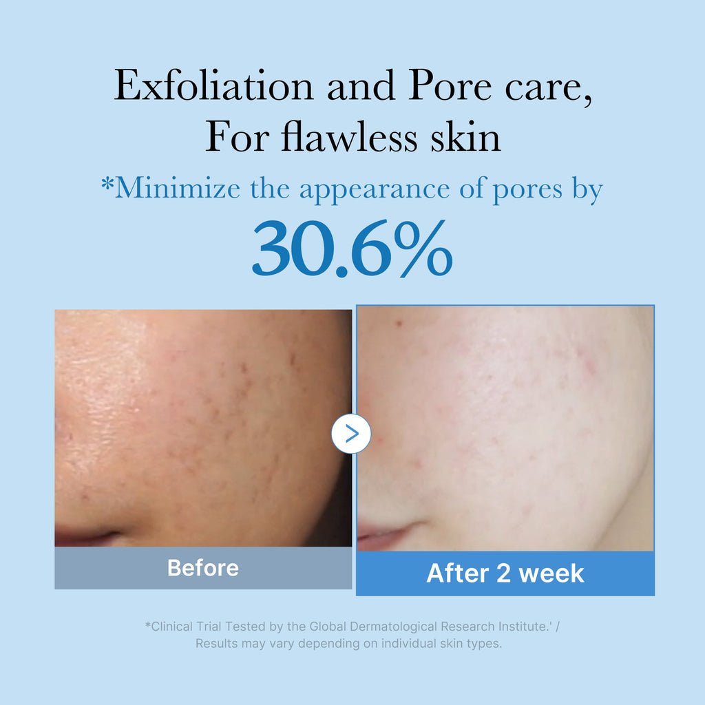 Zero Pore Toner X6