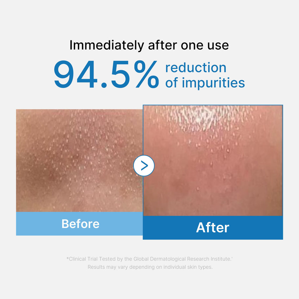 Zero Pore Blackhead Deep Cleansing Oil L7