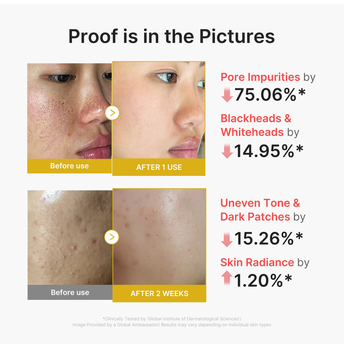 Kojic Acid Turmeric Peel Shot E5