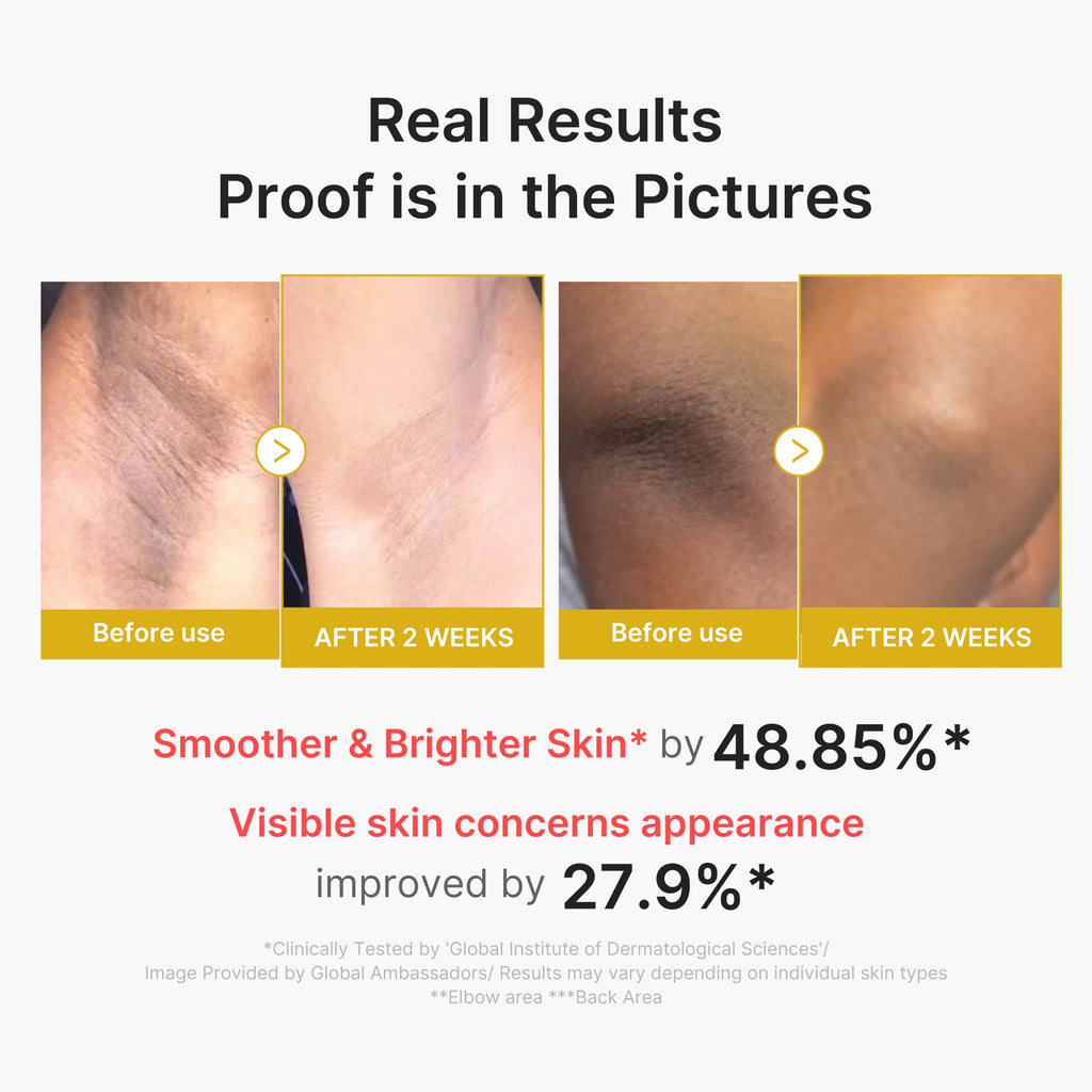 Kojic Acid Turmeric Body Peel Shot I0