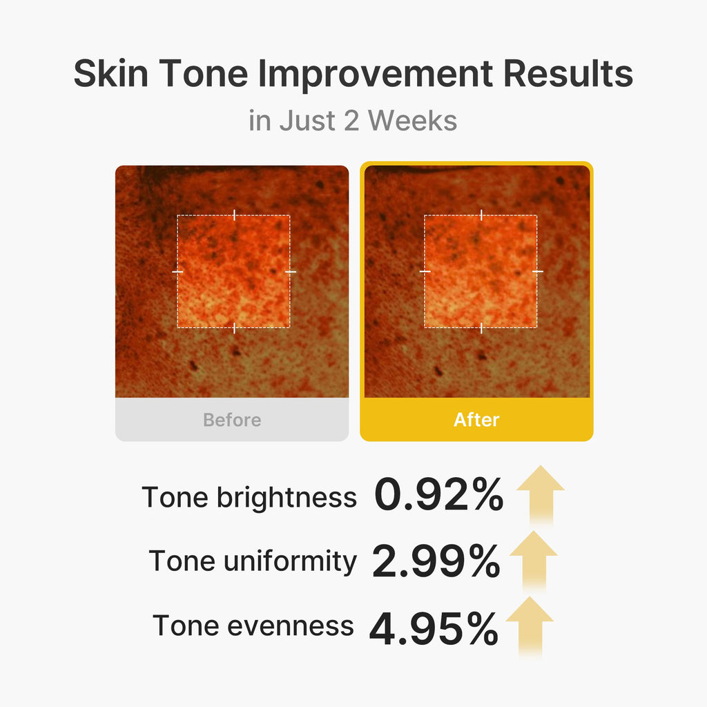 Kojic Acid Turmeric Vita Capsule Cream P5