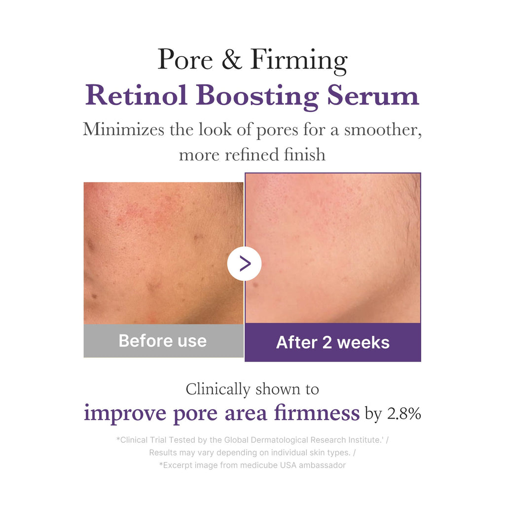 Retinol NMN Boosting Serum Z4