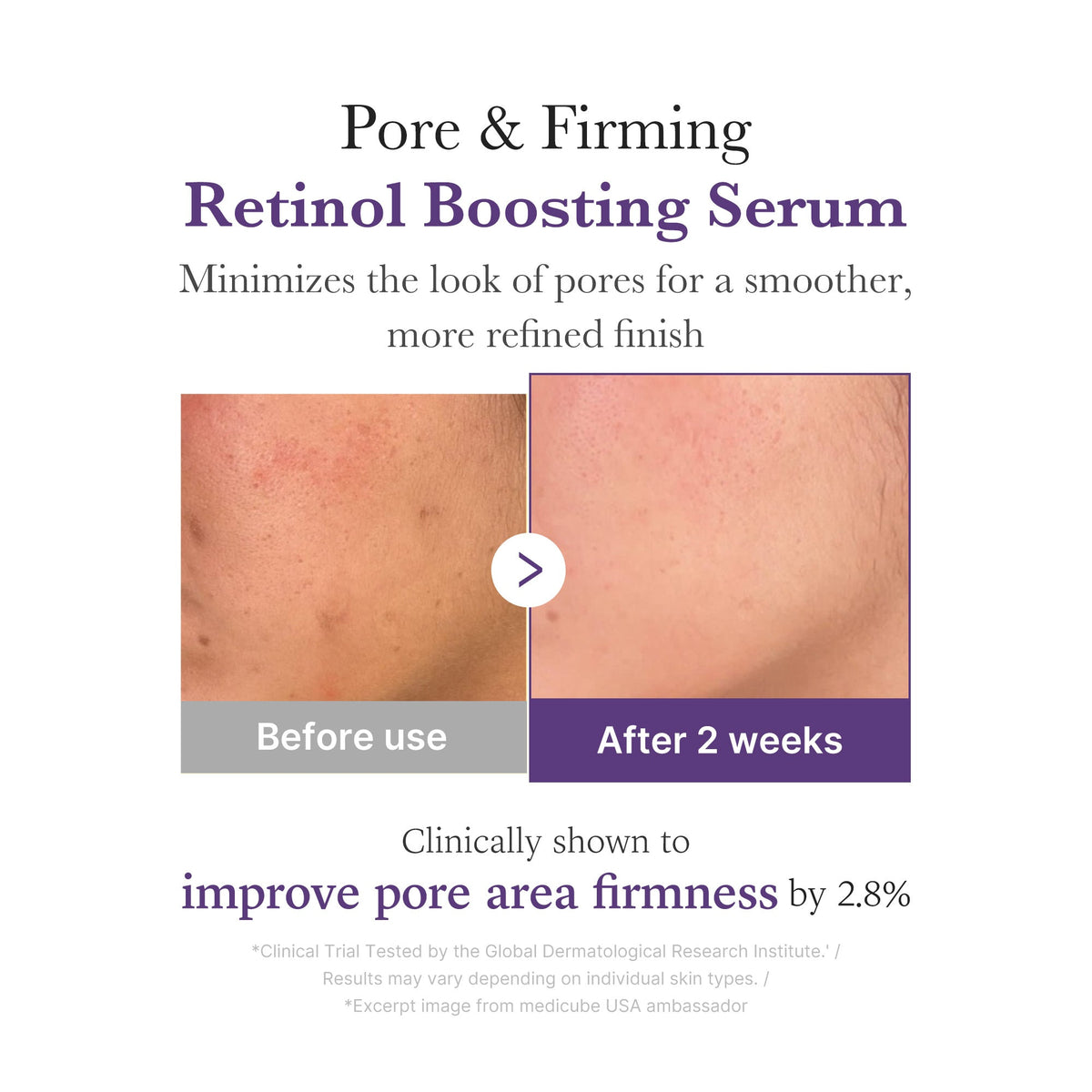 Retinol NMN Boosting Serum Z4