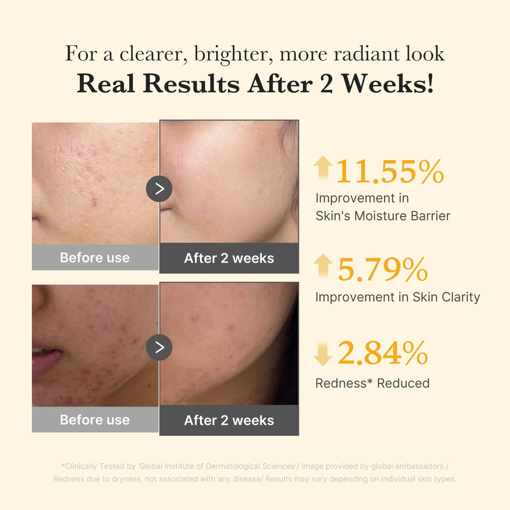 Kojic Acid Turmeric Capsule Serum S7