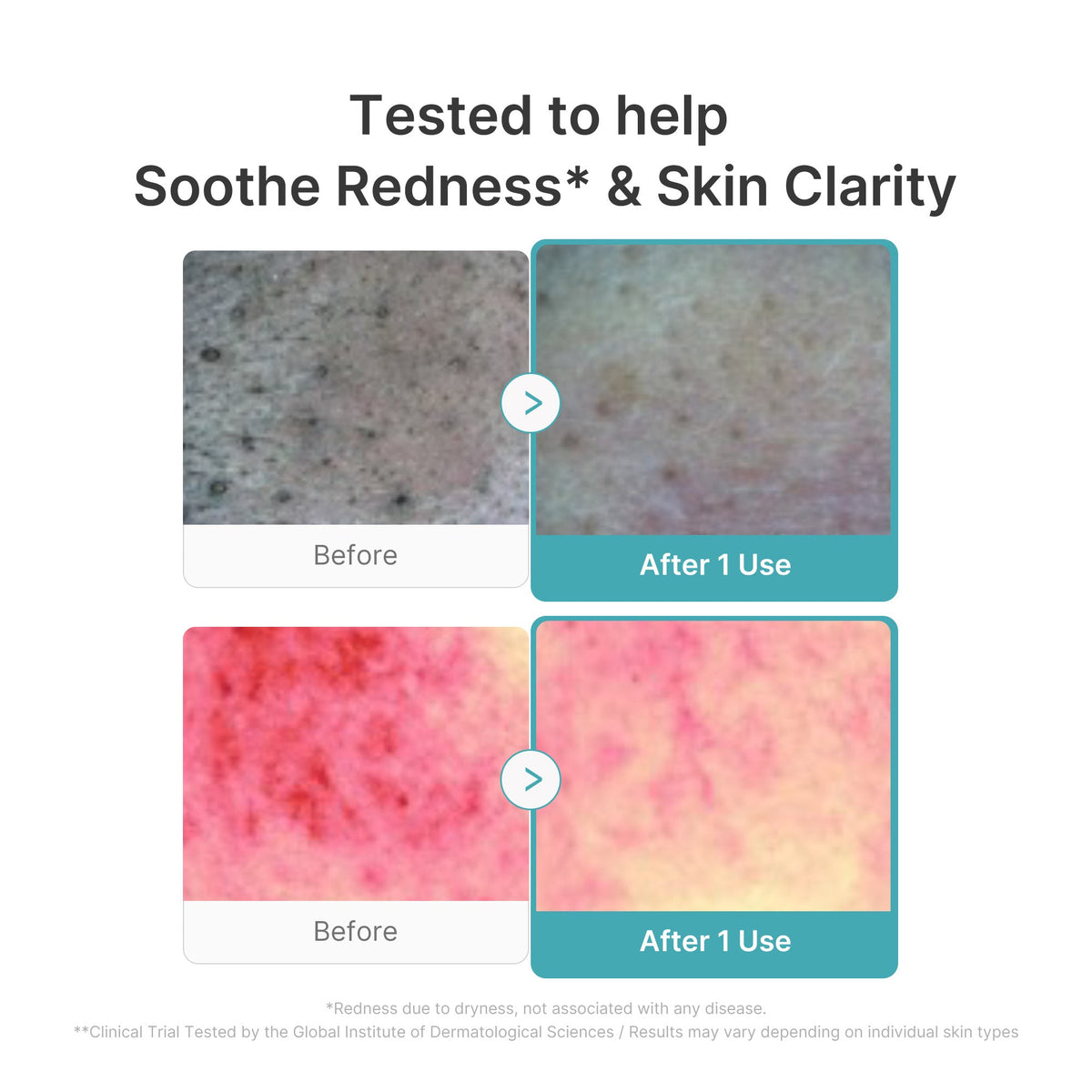 Azelaic Acid Capsule Foam Cleanser F9