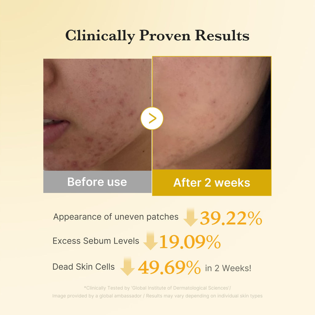 Kojic Acid Tumeric Toner Pad Z7