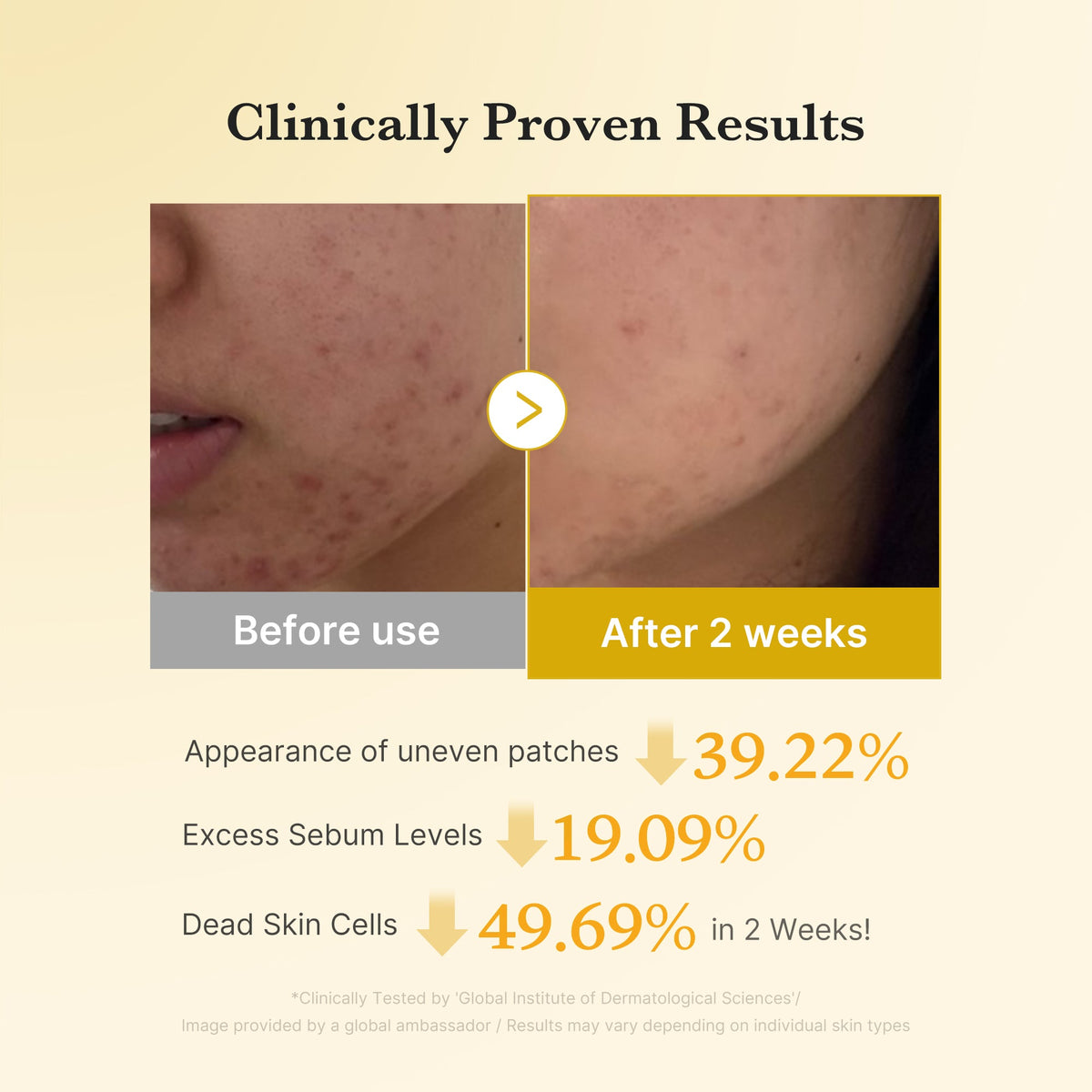 Kojic Acid Tumeric Toner Pad Z7