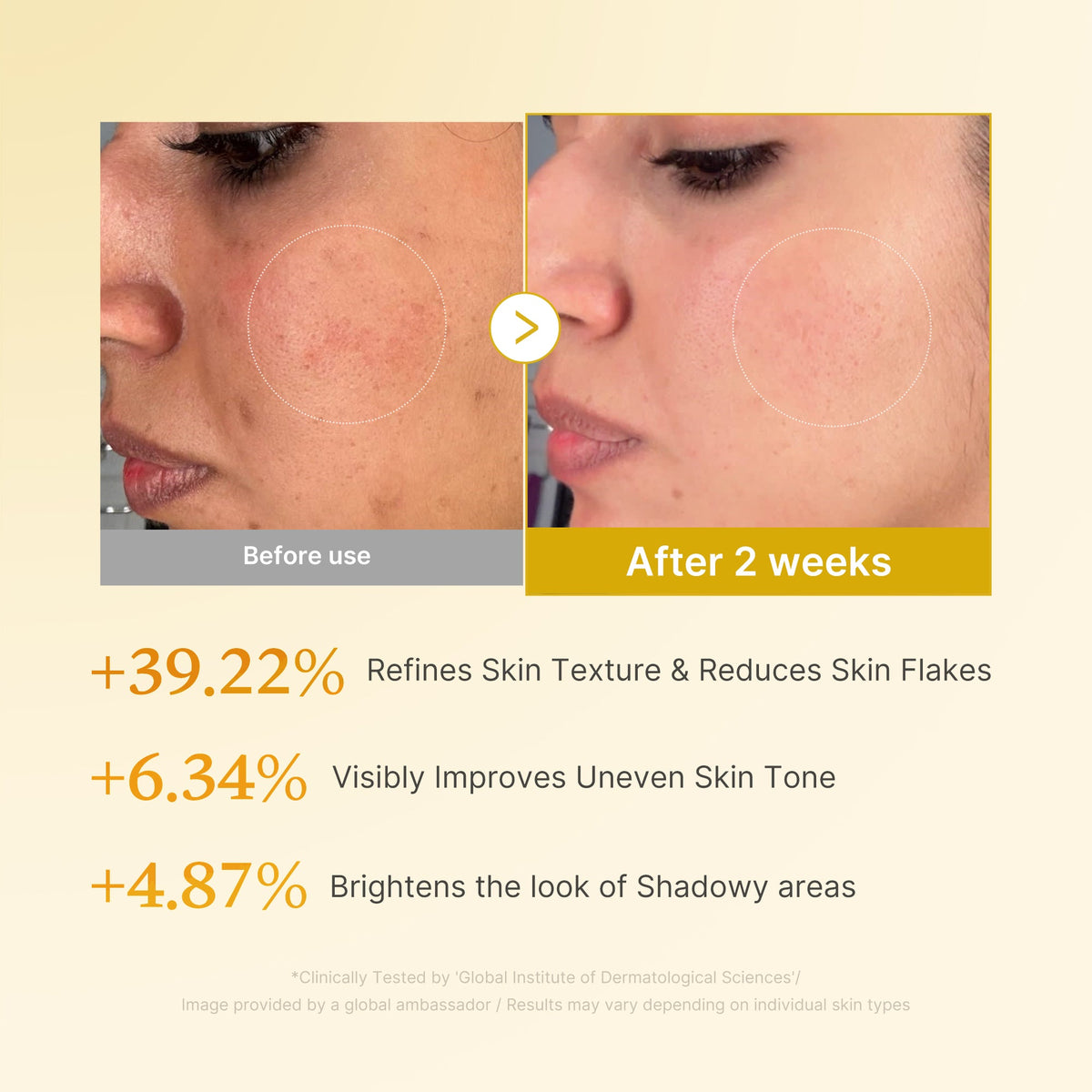 Kojic Acid Turmeric Toner H2