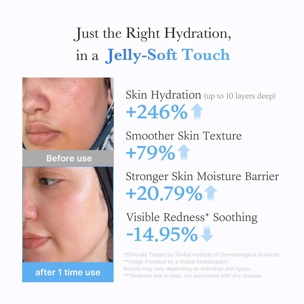 Hyaluronic Ceramide Moisturizing Jelly Cream W1