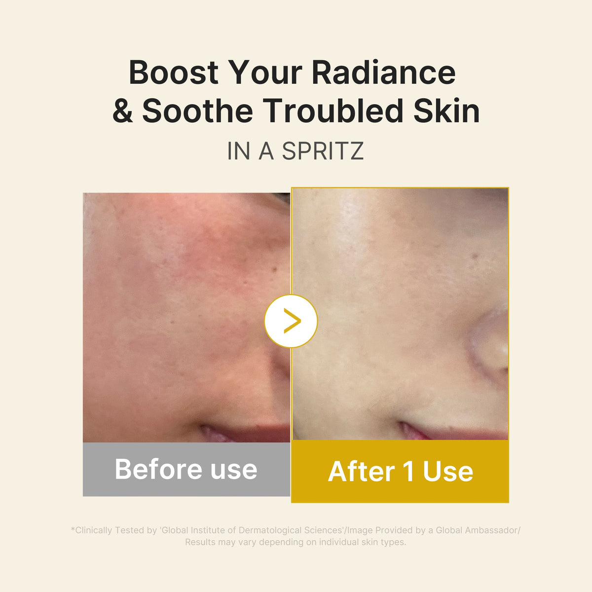 Kojic Acid Turmeric Vitamin Gold Jelly Mist Serum P1