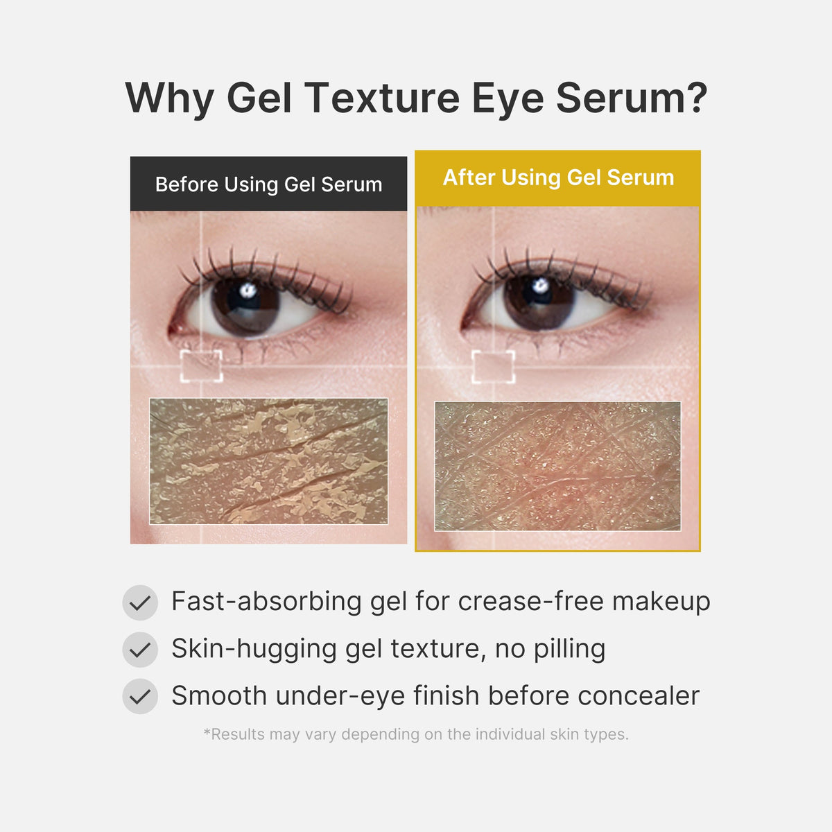 Kojic Acid Tumeric Eye Gel Serum H2