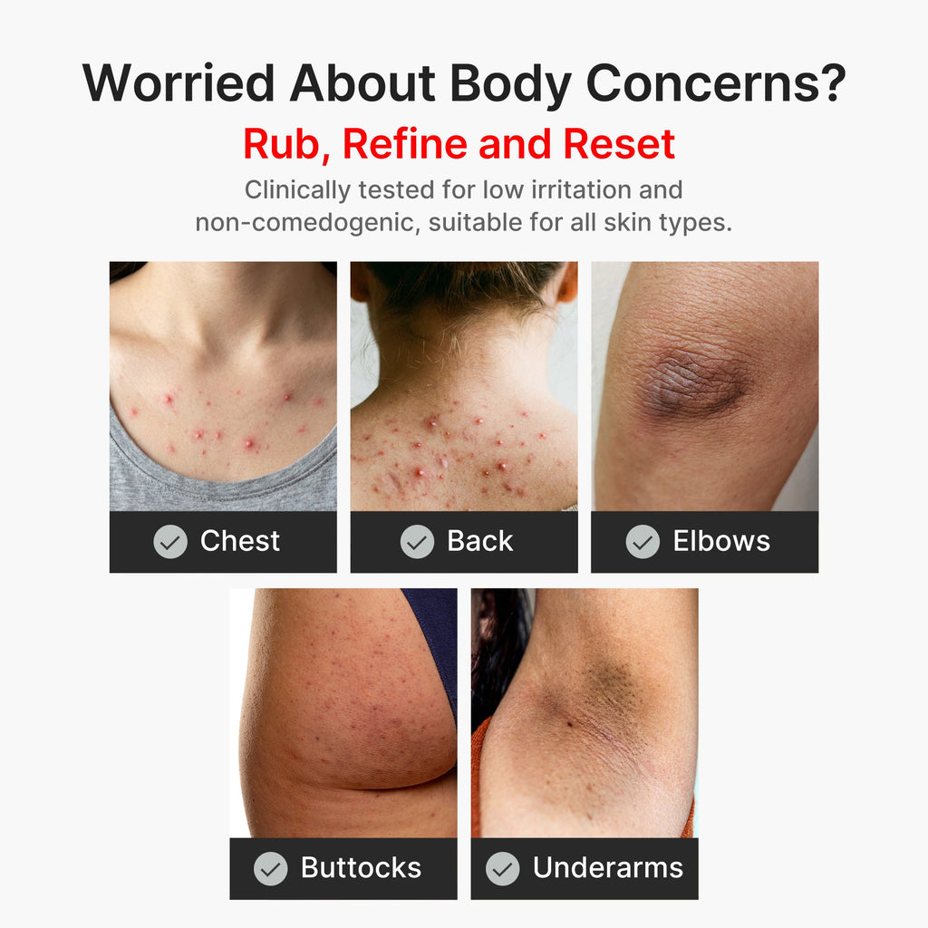Kojic Acid Turmeric Body Peel Shot I0