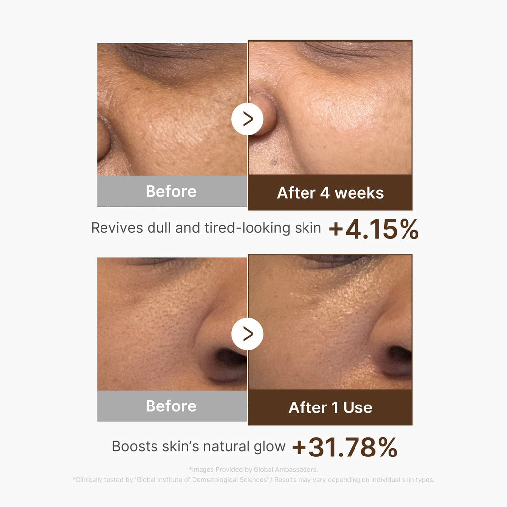 Deep Vitamin C Capsule Serum R5