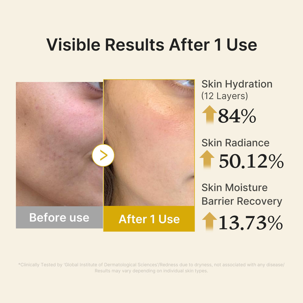 Kojic Acid Turmeric Vitamin Gold Jelly Mist Serum P1
