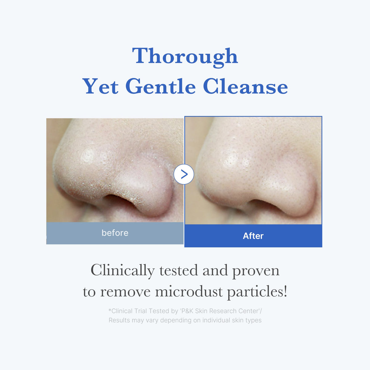 Zero Foam Cleanser B5