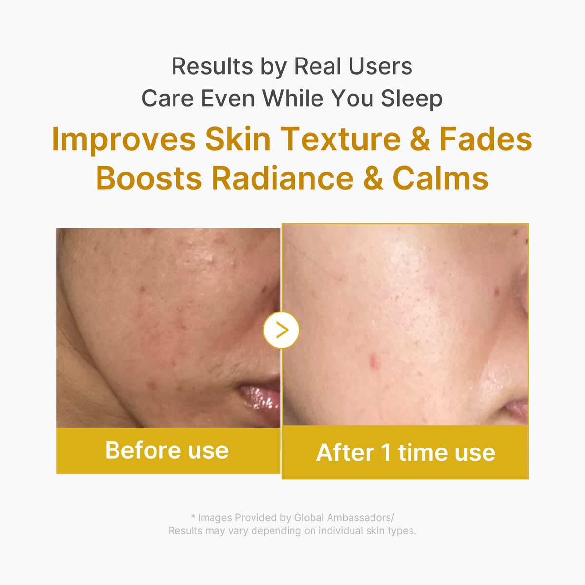 Kojic Acid Turmeric Overnight Wrapping Mask S7