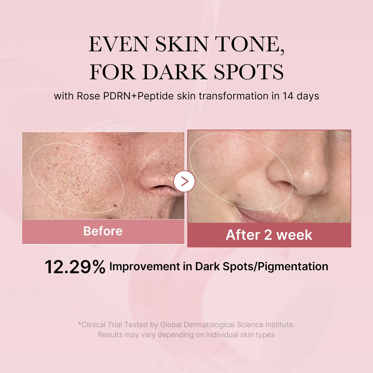 PDRN Pink Peptide Toner N5