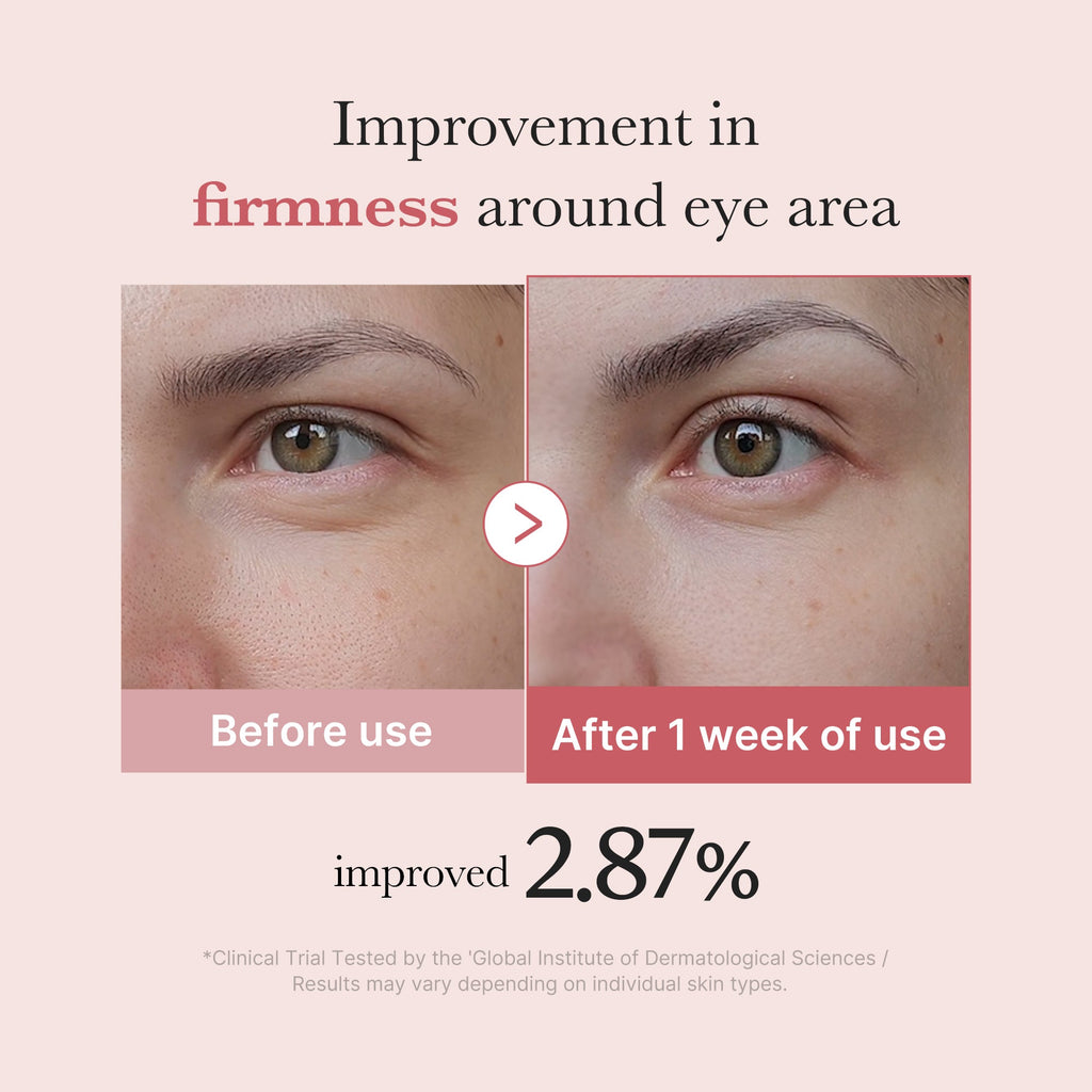 PDRN Pink Peptide Eye Cream S8