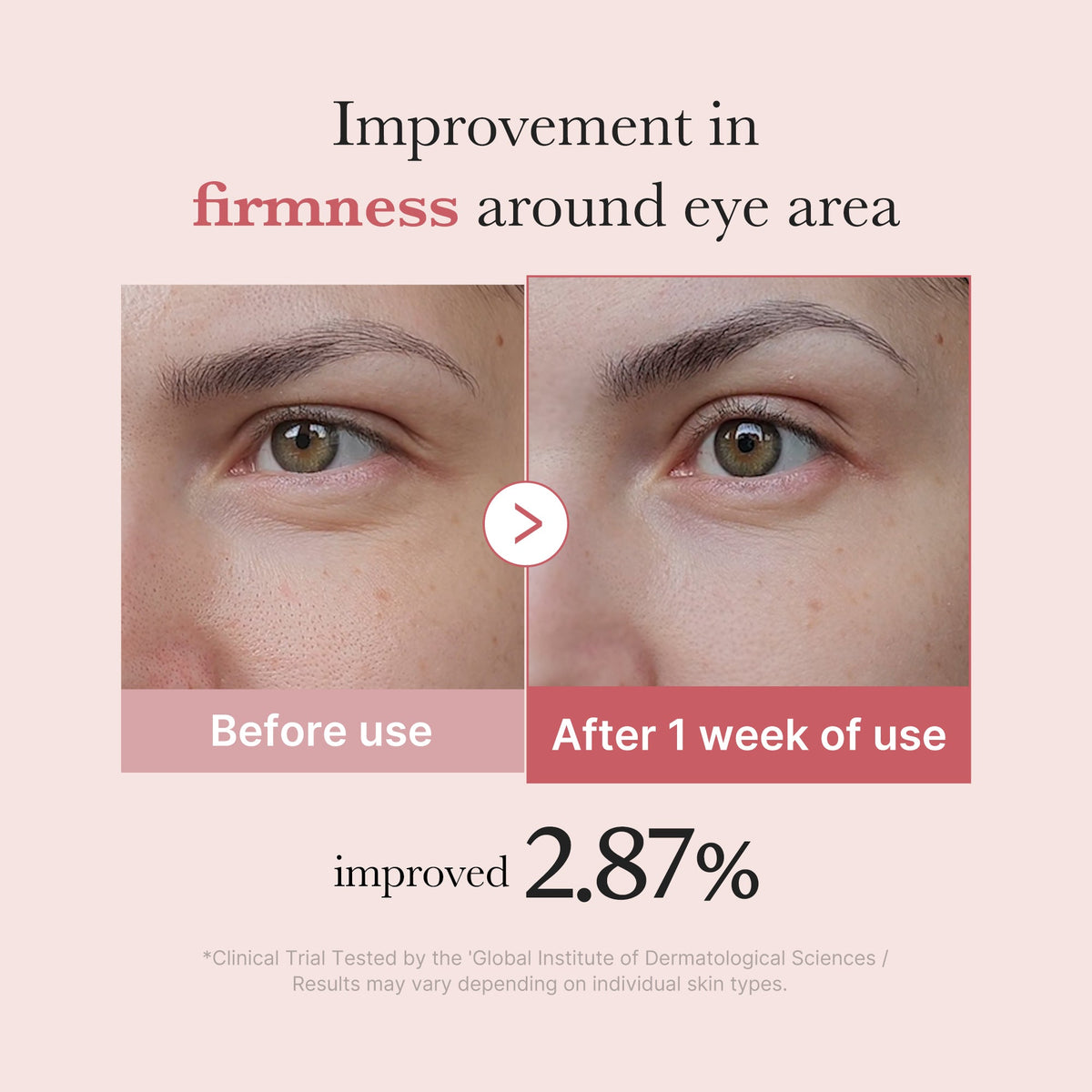 PDRN Pink Peptide Eye Cream S8
