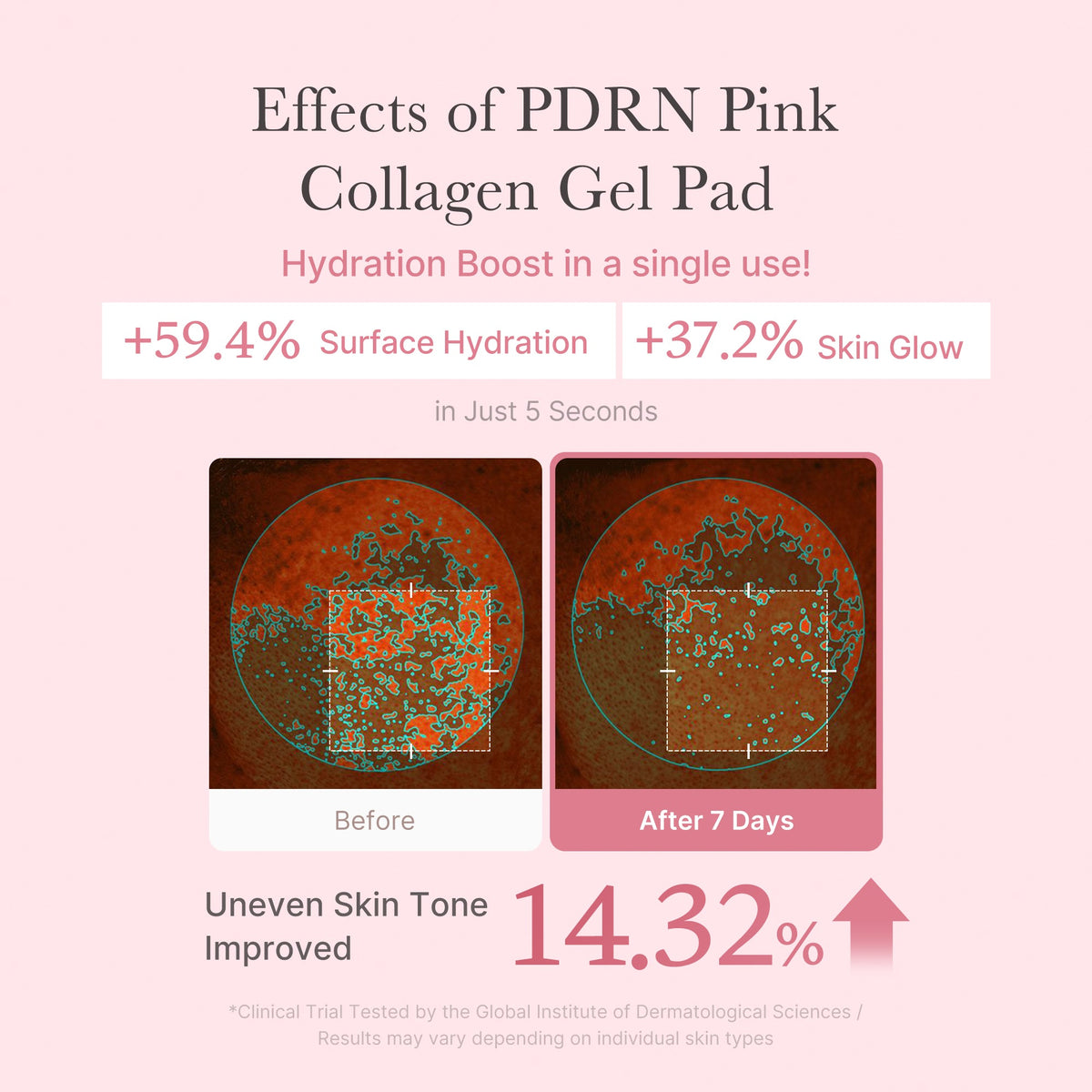 PDRN Pink Collagen Gel Toner Pad E7