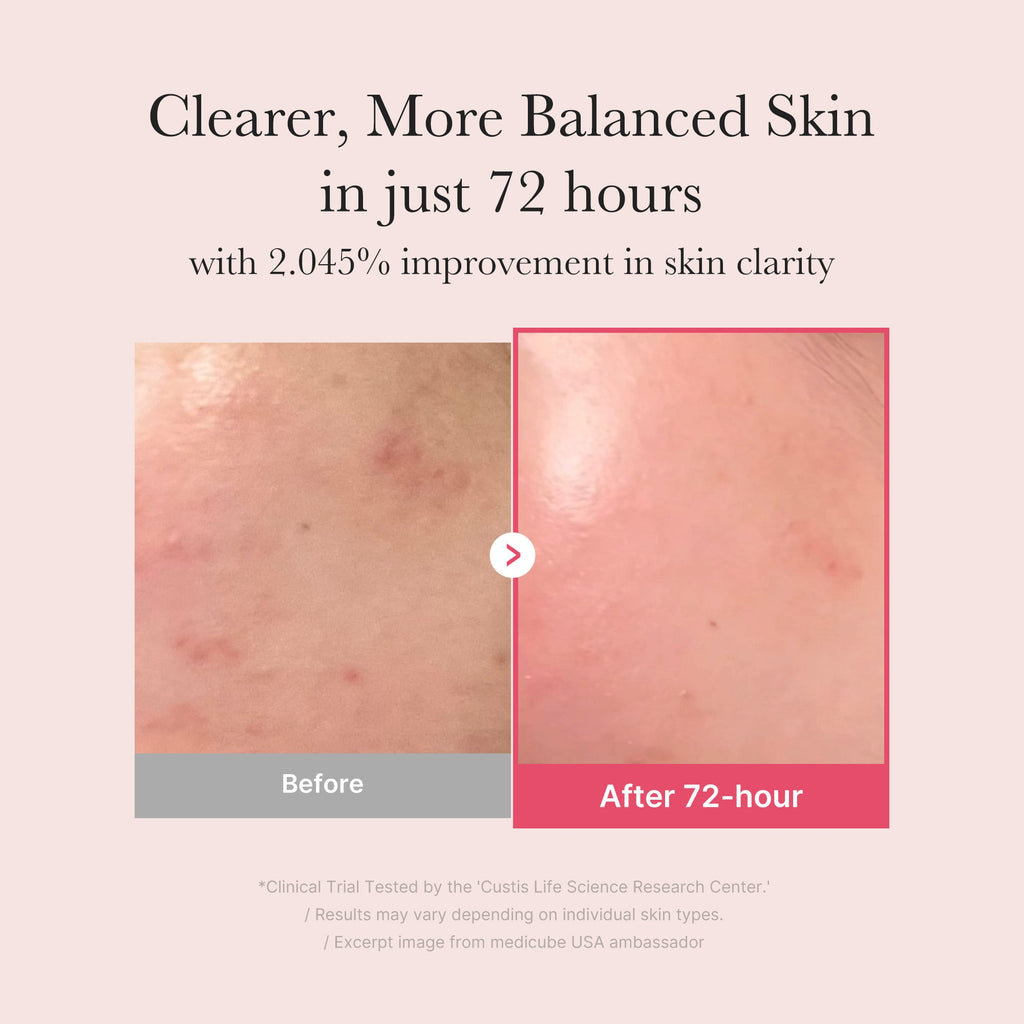 TXA Niacinamide Serum J5
