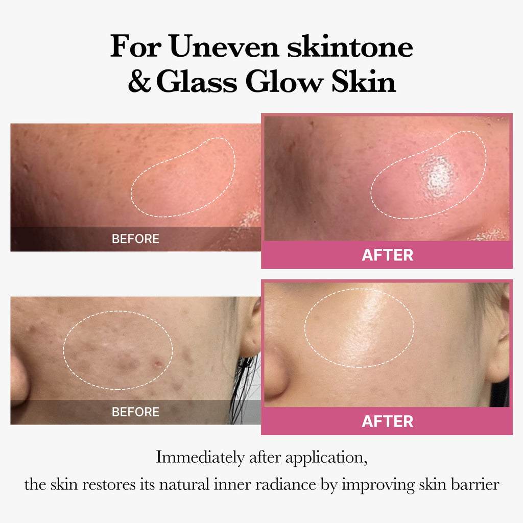 [Tati's Exclusive] Plump Perfection Set M0